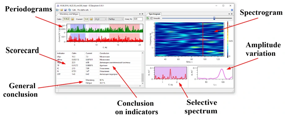 Passive, Non-Invasive Diagnostic System for Detecting Fatigue and Psycho Emotional Stress